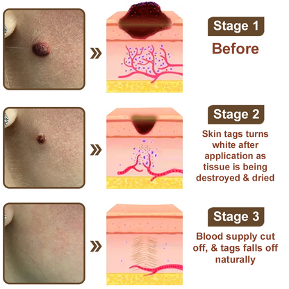 Black Rice Skin Repair Essence Cream 👨‍⚕️ FDA Certified (Removes warts and skin growths, improves keratin buildup and seborrheic dermatitis, follicular keratosis, age spots, and bruising)