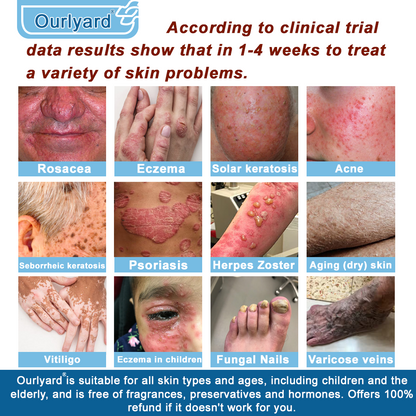 ✅Mayo Clinic Official: Magnesium skin repair cream (Eczema and Psoriasis Relief, Skin Repair, Even Tone, Acne and Dark Spot Treatment, Wart and Mole Removal)