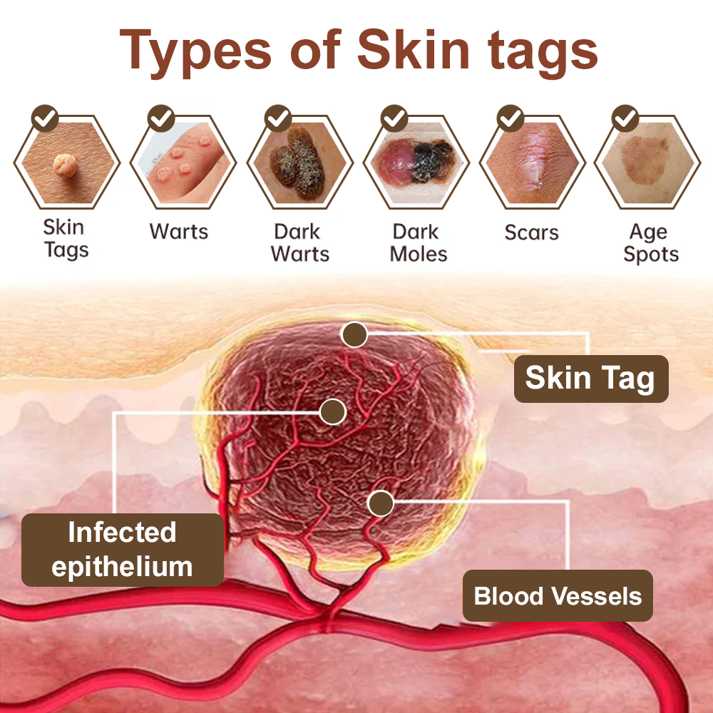 Black Rice Skin Repair Essence Cream 👨‍⚕️ FDA Certified (Removes warts and skin growths, improves keratin buildup and seborrheic dermatitis, follicular keratosis, age spots, and bruising)