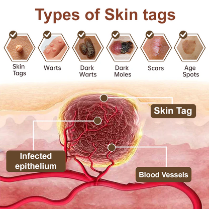 Black Rice Skin Repair Essence Cream 👨‍⚕️ FDA Certified (Removes warts and skin growths, improves keratin buildup and seborrheic dermatitis, follicular keratosis, age spots, and bruising)