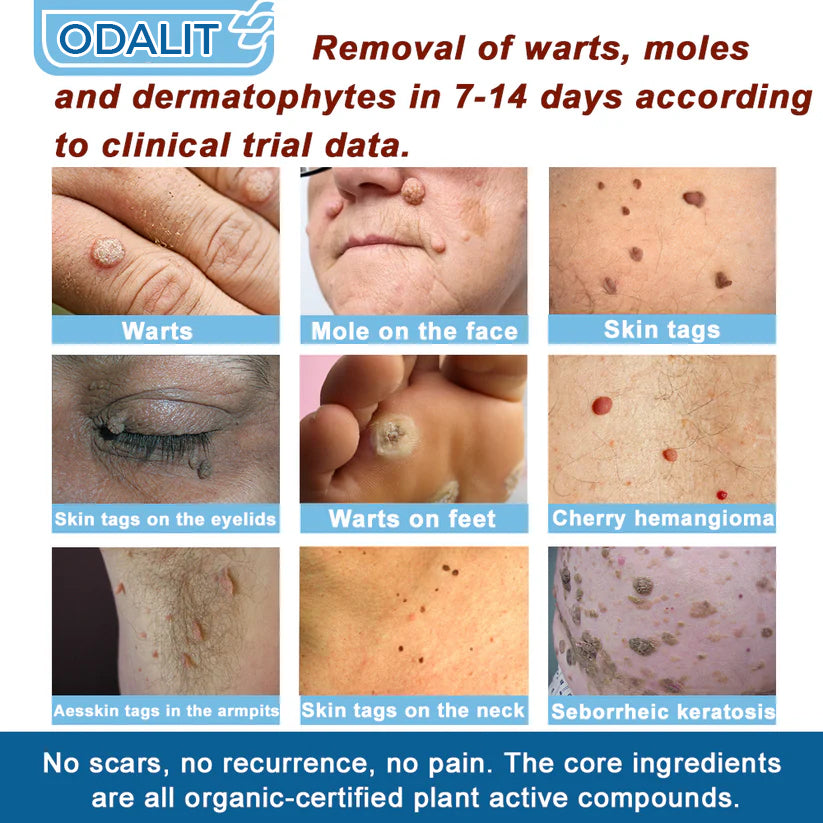 🏆✅Mayo Clinic Official: Magnesium skin repair cream (Eczema and Psoriasis Relief, Skin Repair, Even Tone, Acne and Dark Spot Treatment, Wart and Mole Removal)