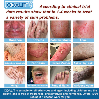 🏆✅Mayo Clinic Official: Magnesium skin repair cream (Eczema and Psoriasis Relief, Skin Repair, Even Tone, Acne and Dark Spot Treatment, Wart and Mole Removal)