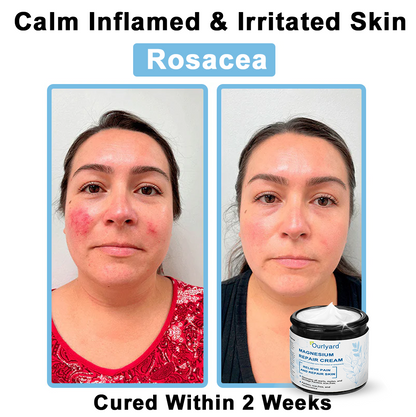 ✅Mayo Clinic Official: Magnesium skin repair cream (Eczema and Psoriasis Relief, Skin Repair, Even Tone, Acne and Dark Spot Treatment, Wart and Mole Removal)