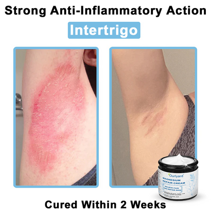 ✅Mayo Clinic Official: Magnesium skin repair cream (Eczema and Psoriasis Relief, Skin Repair, Even Tone, Acne and Dark Spot Treatment, Wart and Mole Removal)