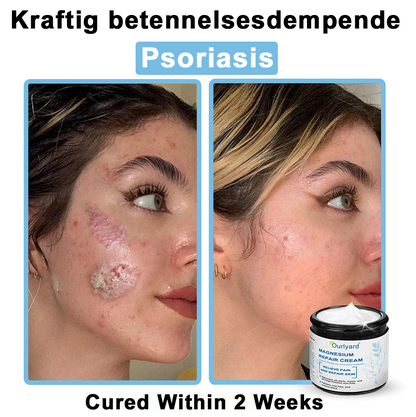 ✅Mayo Clinic Official: Magnesium skin repair cream (Eczema and Psoriasis Relief, Skin Repair, Even Tone, Acne and Dark Spot Treatment, Wart and Mole Removal)