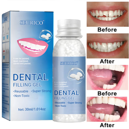 🦷 Seurico™ Dental Filling Gel– Fix Cavities Fast Without Pain or Drills 💖