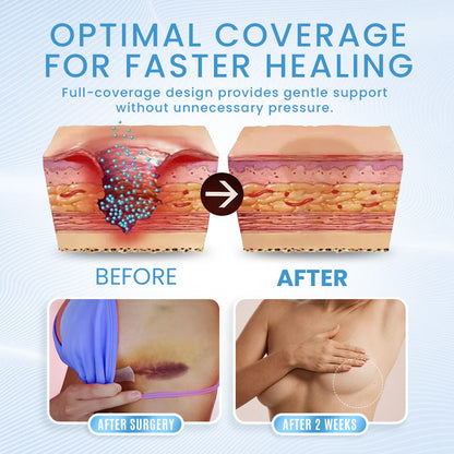 Expert Bras for Post-Op Comfort