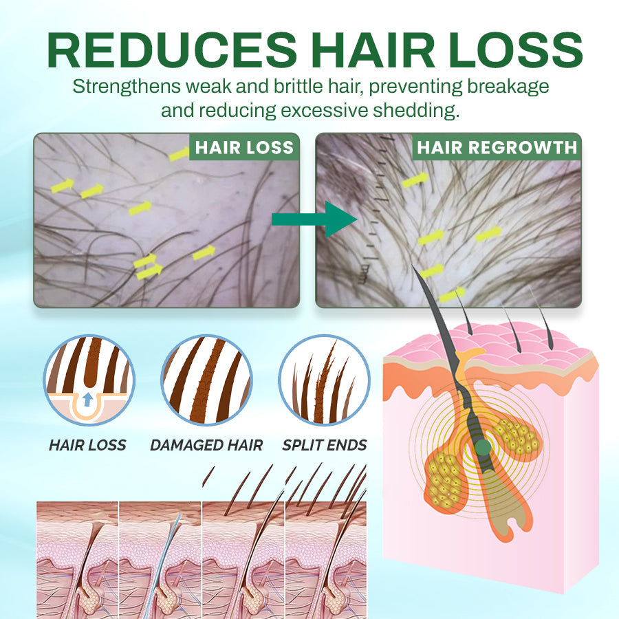 Seurico™ Natural Hair Growth Essence