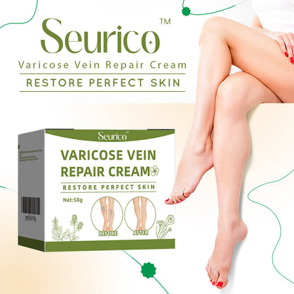 Seurico™ Varicose Vein Relief Cream🌿