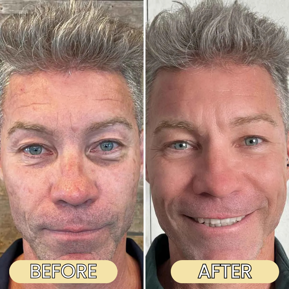 Organic Grass-Fed Beef Tallow Balm