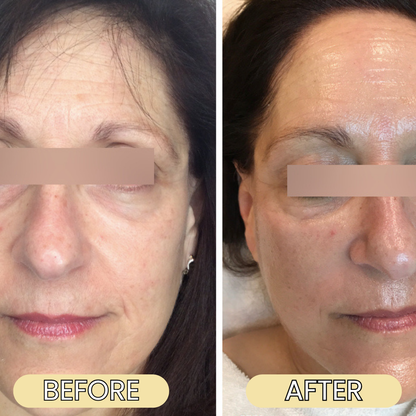 Organic Grass-Fed Beef Tallow Balm