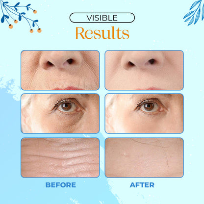 Botox Facial Anti-aging Serum