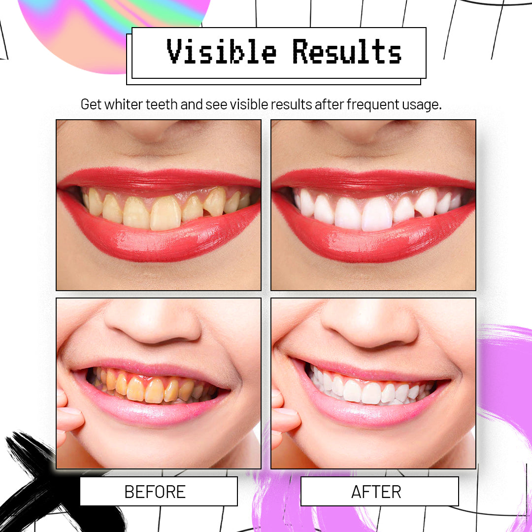 AngelSmile™ Color-Correcting Purple Mousse Toothpaste