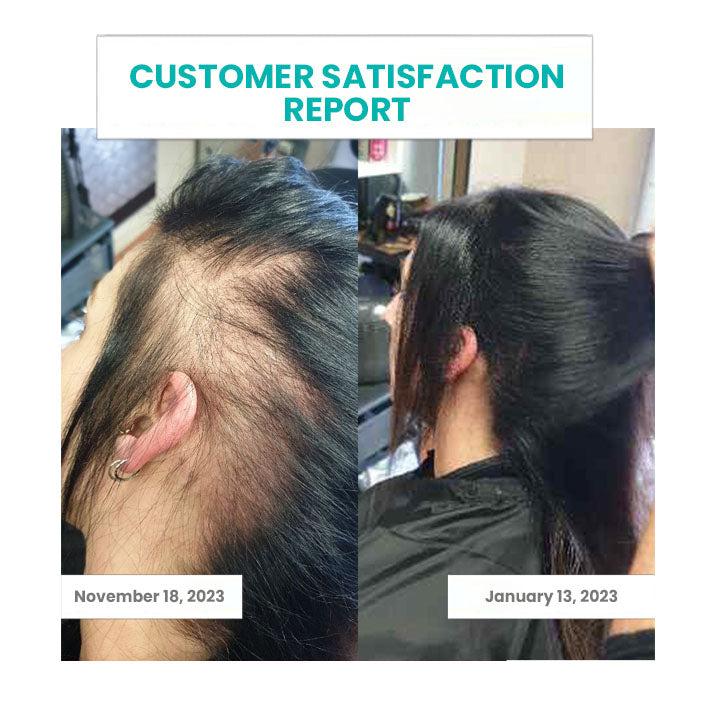 Oveallgo™ ScalpReboost NMN Hair Growth Roller